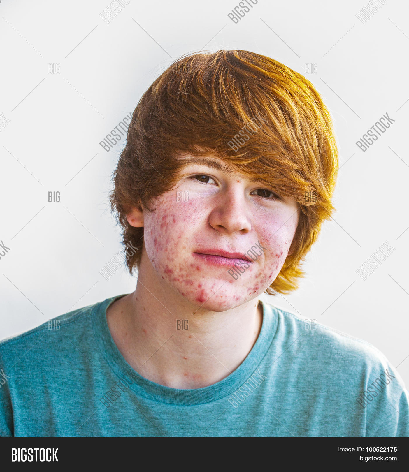 acne,active,adolescent,arrieta,boy,care,caucasian,child,confident,cute,emotion,europe,european,expression,face,friendly,gesture,glasses,hair,handsome,happy,kid,nature,people,pick,pickax,pickle,pimple,portrait,positive,problem,puberty,reading,red,sad,shirt,skin,skincare,smile,spain,summer,teen