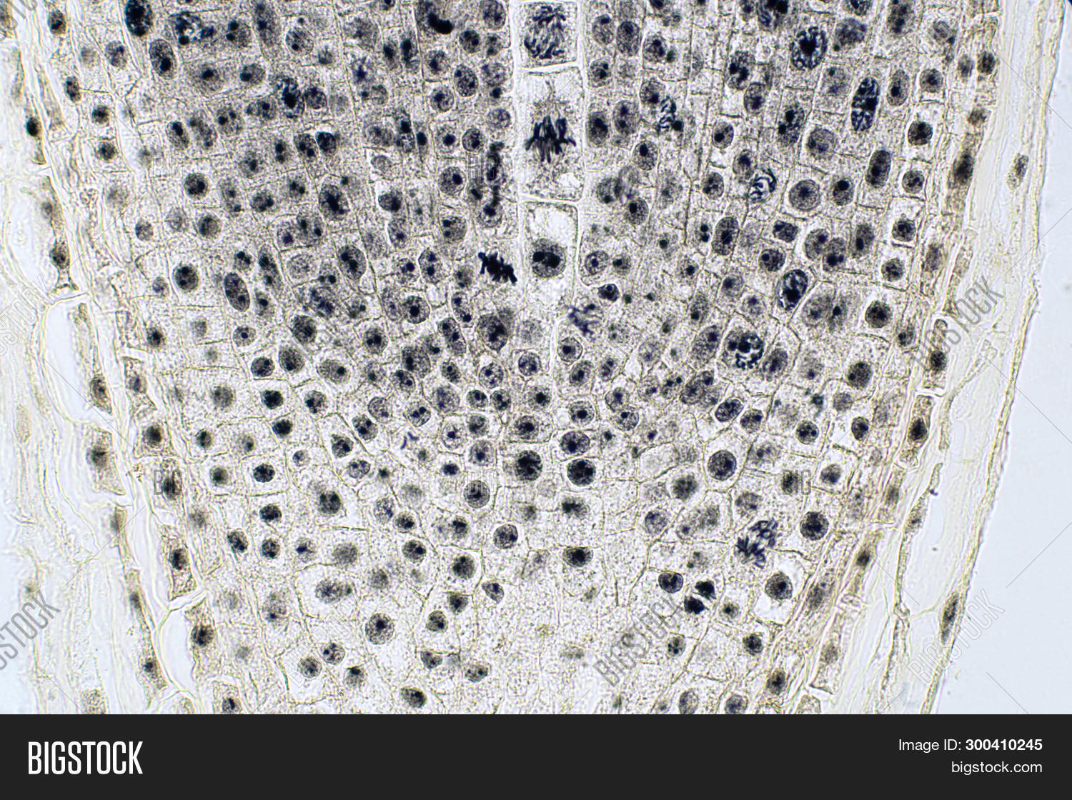 anaphase,apoptosis,biology,cell,cellular,centromeres,chromosome,cycle,cytokinesis,cytology,cytoplasmic,death,dividing,division,dna,genetic,haploid,histology,homologous,interphase,laboratory,living,meiosis,membrane,metabolism,metaphase,micronucleus,microscope,microscopic,microscopy,mitosis,mitotic,mutant,nucleolus,nucleus,onion,phase,plant,prometaphase,prophase,replication,rna,root,stem,telophase,tip,tissue,under