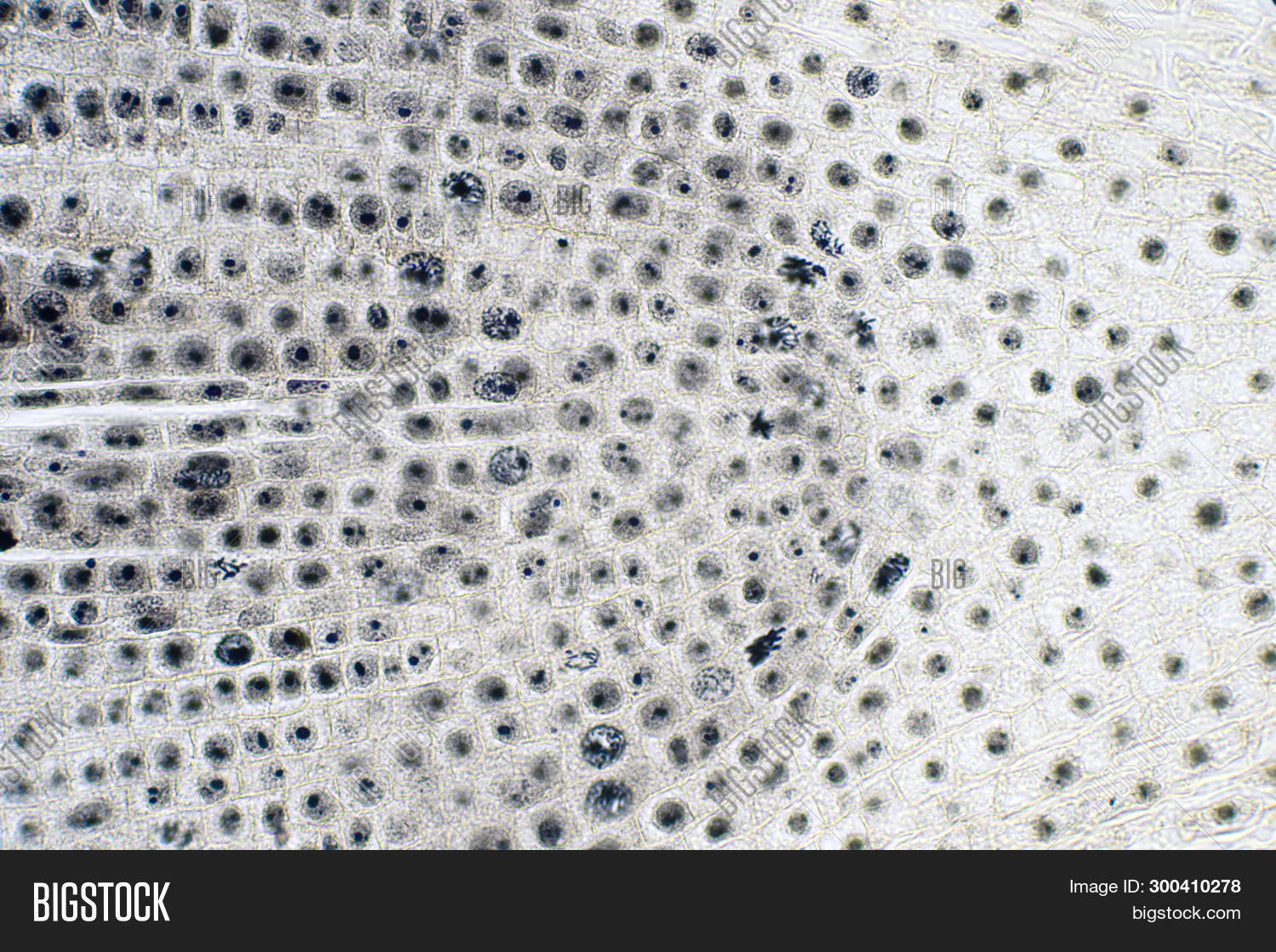 anaphase,apoptosis,biology,cell,cellular,centromeres,chromosome,cycle,cytokinesis,cytology,cytoplasmic,death,dividing,division,dna,genetic,haploid,histology,homologous,interphase,laboratory,living,meiosis,membrane,metabolism,metaphase,micronucleus,microscope,microscopic,microscopy,mitosis,mitotic,mutant,nucleolus,nucleus,onion,phase,plant,prometaphase,prophase,replication,rna,root,stem,telophase,tip,tissue,under