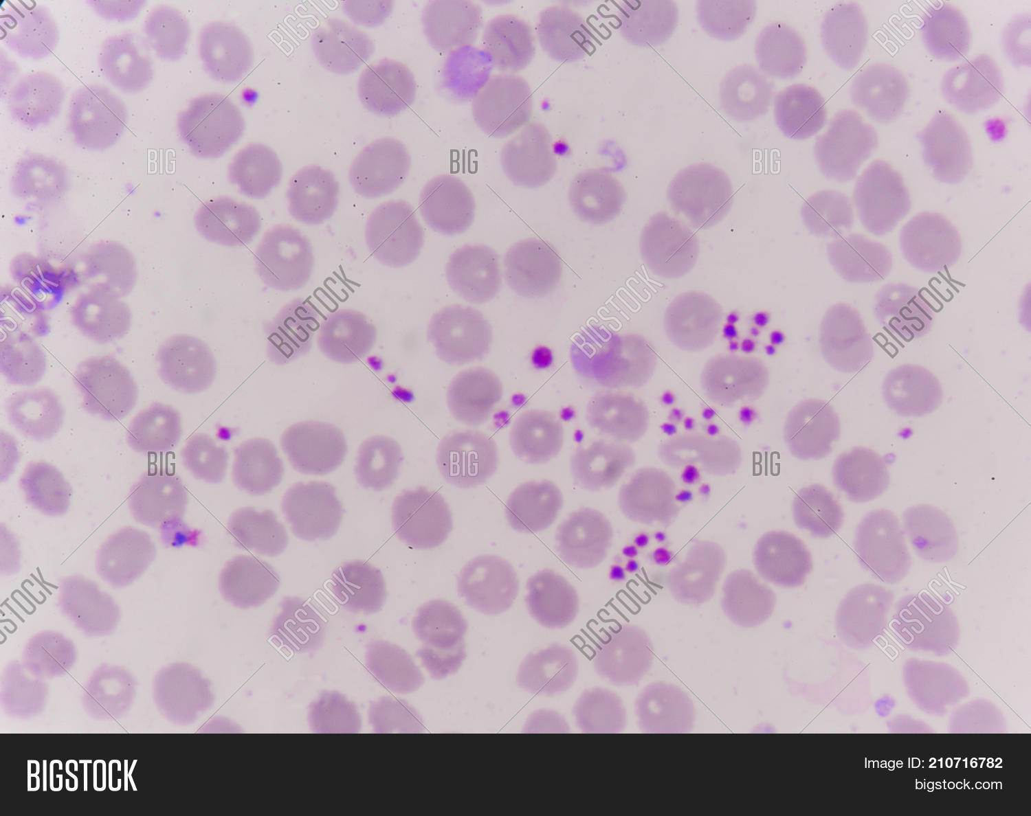 Technology,activated,biochemistry,biology,biotechnology,blood,care,cell,centrifuge,clinic,discovery,doctor,drug,equipment,experiment,health,healthcare,hold,hospital,human,injection,knee,lab,liquid,machine,medical,medicine,person,plasma,platelet,prp,red,researcher,rich,sample,science,therapy,tube,white