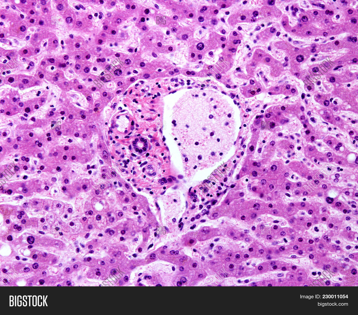 area,bile,cell,duct,hepatic,hepatocyte,histology,light,liver,micrograph,microscope,microscopy,portal,tissue,triad