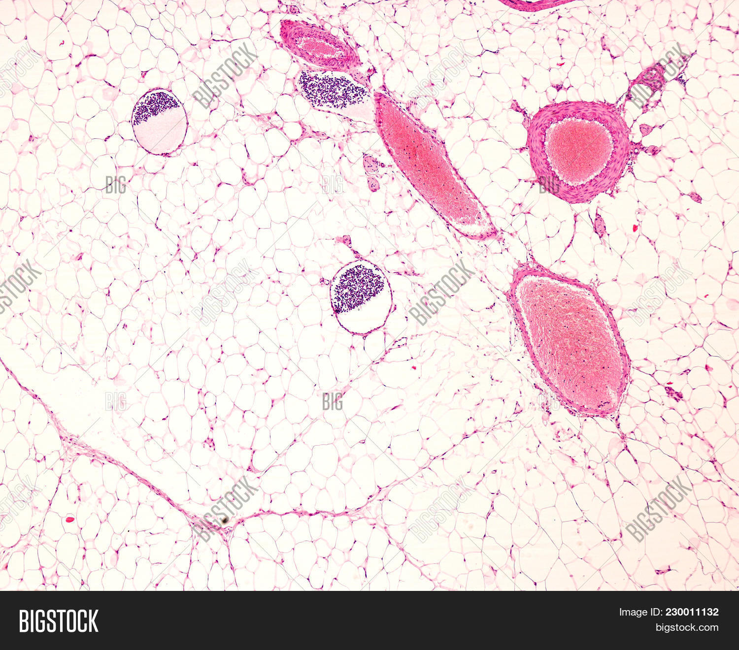 adipose,artery,blood,cell,circulatory,fat,histology,lymphatic,microscopic,microscopy,system,tissue,vascular,vein,vessel