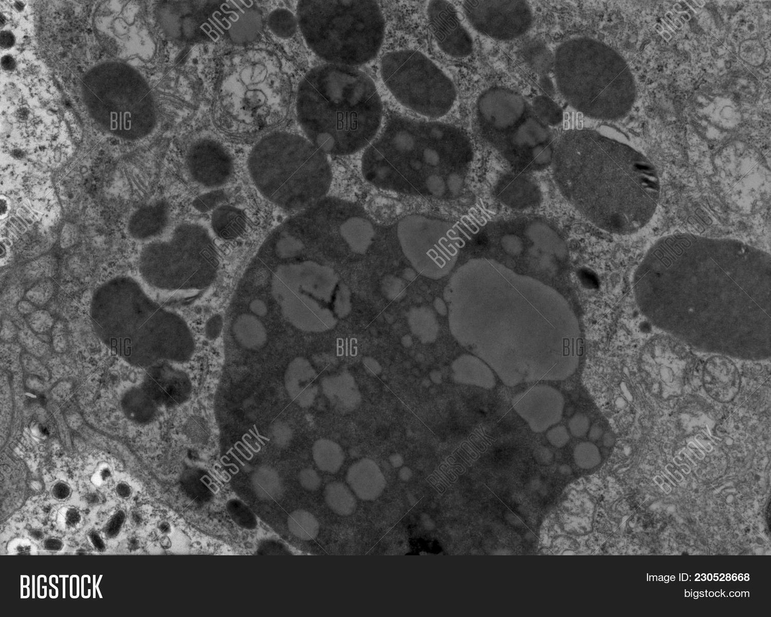 TEM,adrenal,biology,bodies,cell,cytology,dense,electron,fine,gland,granules,histology,lipofuscin,lysosomes,medulla,micrograph,microscope,microscopy,noradrenaline,organelles,structure,ultrastructure