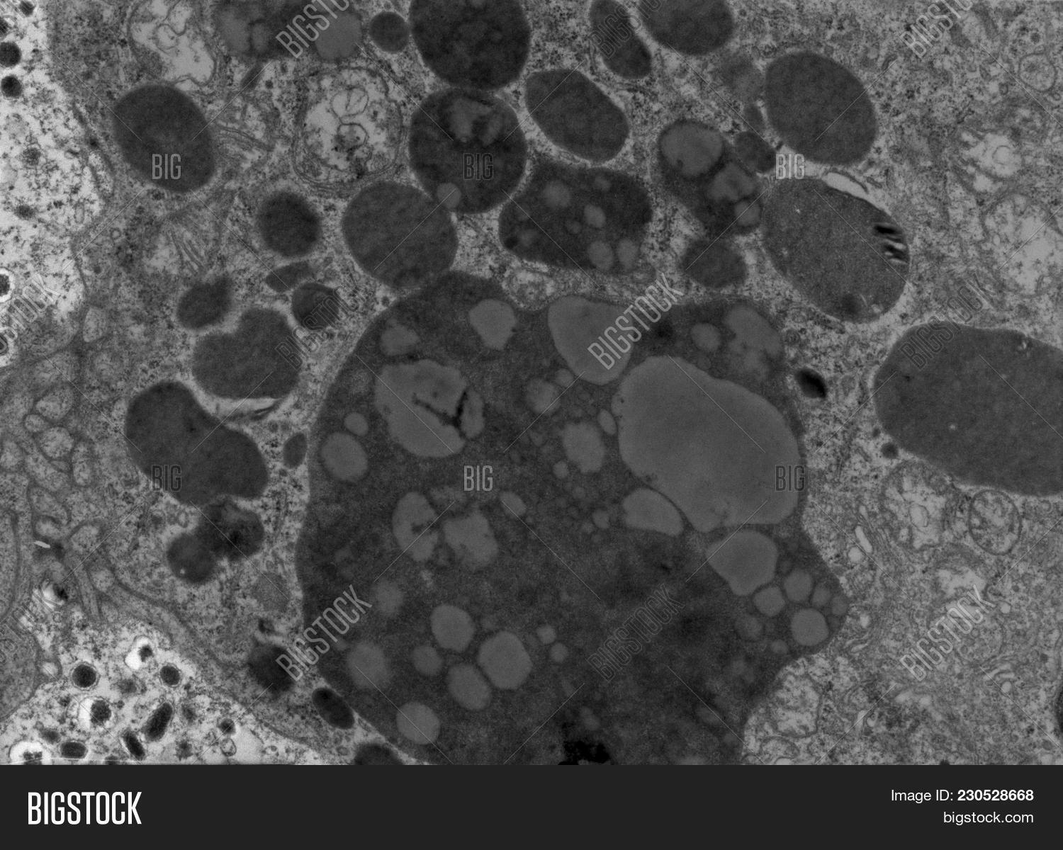 Transmission Electron Microscope (tem) Micrograph Showing Many ...