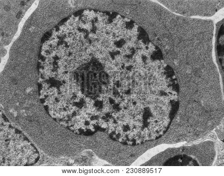 False Colour Transmission Electron Microscope (tem) Micrograph Of A B ...