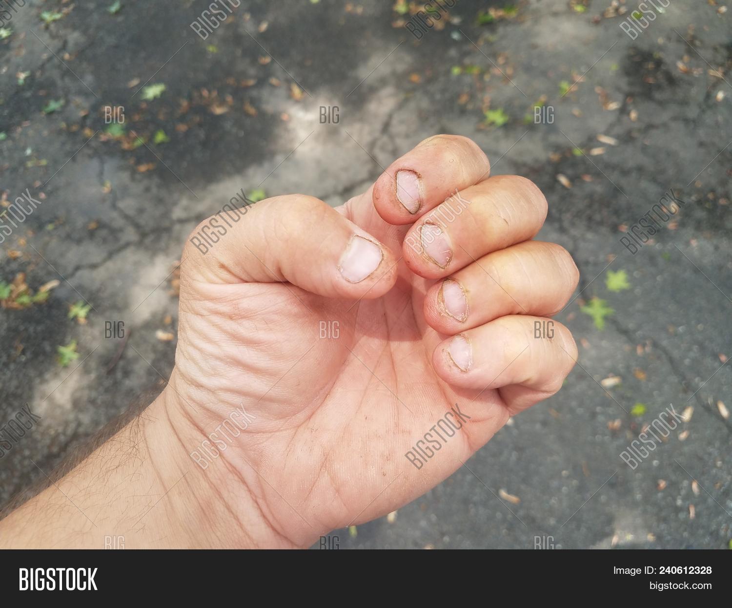 dirt,dirty,disgusting,filthy,fingernails,fingers,gross,hand,nails