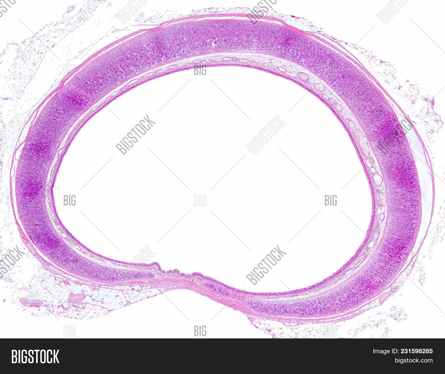 cartilage,cell,epithelium,histology,microscope,microscopy,mucosae,prismatic,pseudostratified,respiratory,rings,tissue,trachea,tracheal