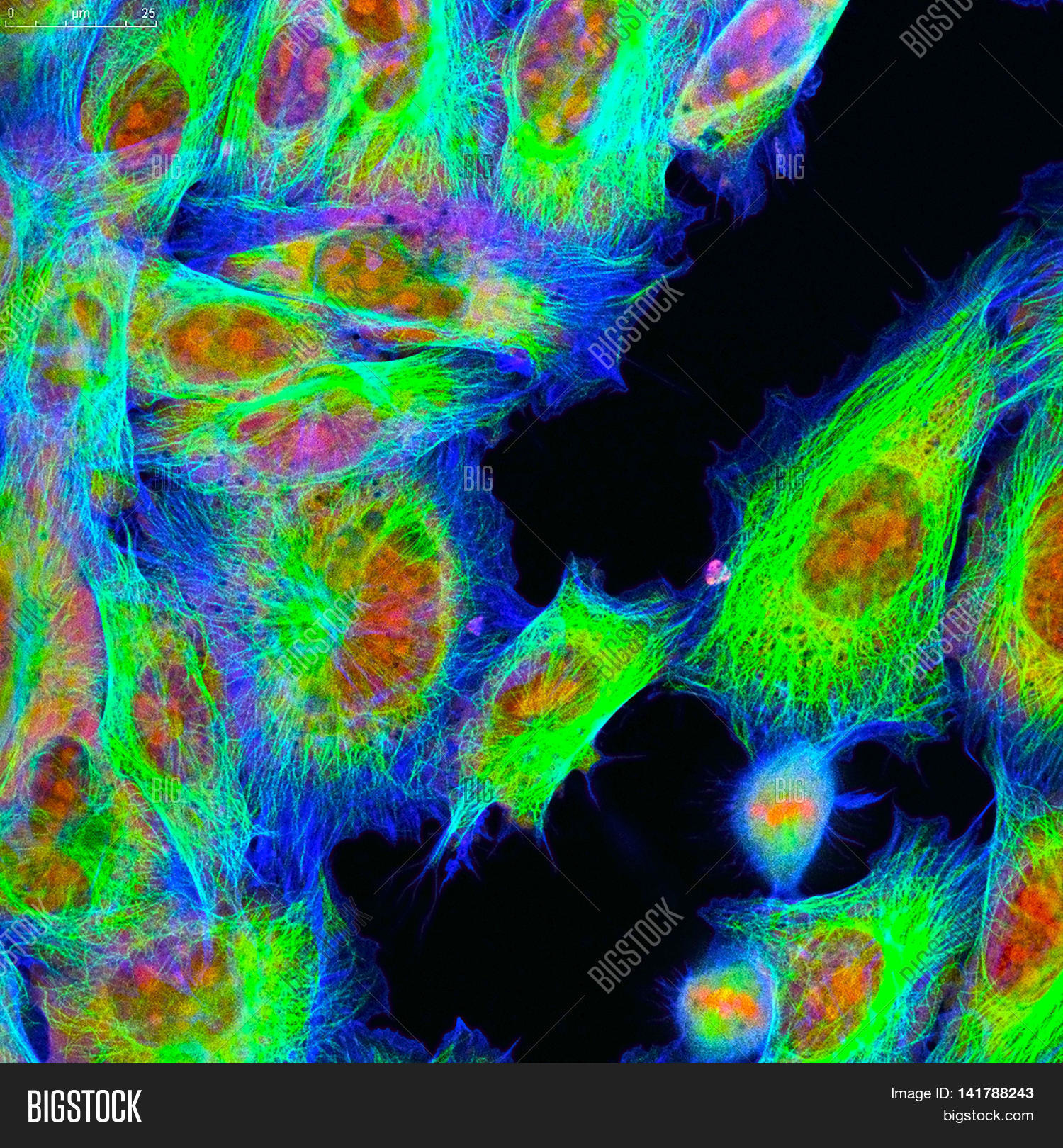 Confocal Microscopy Of Fibroblast Cells image & stock photo. 141788243