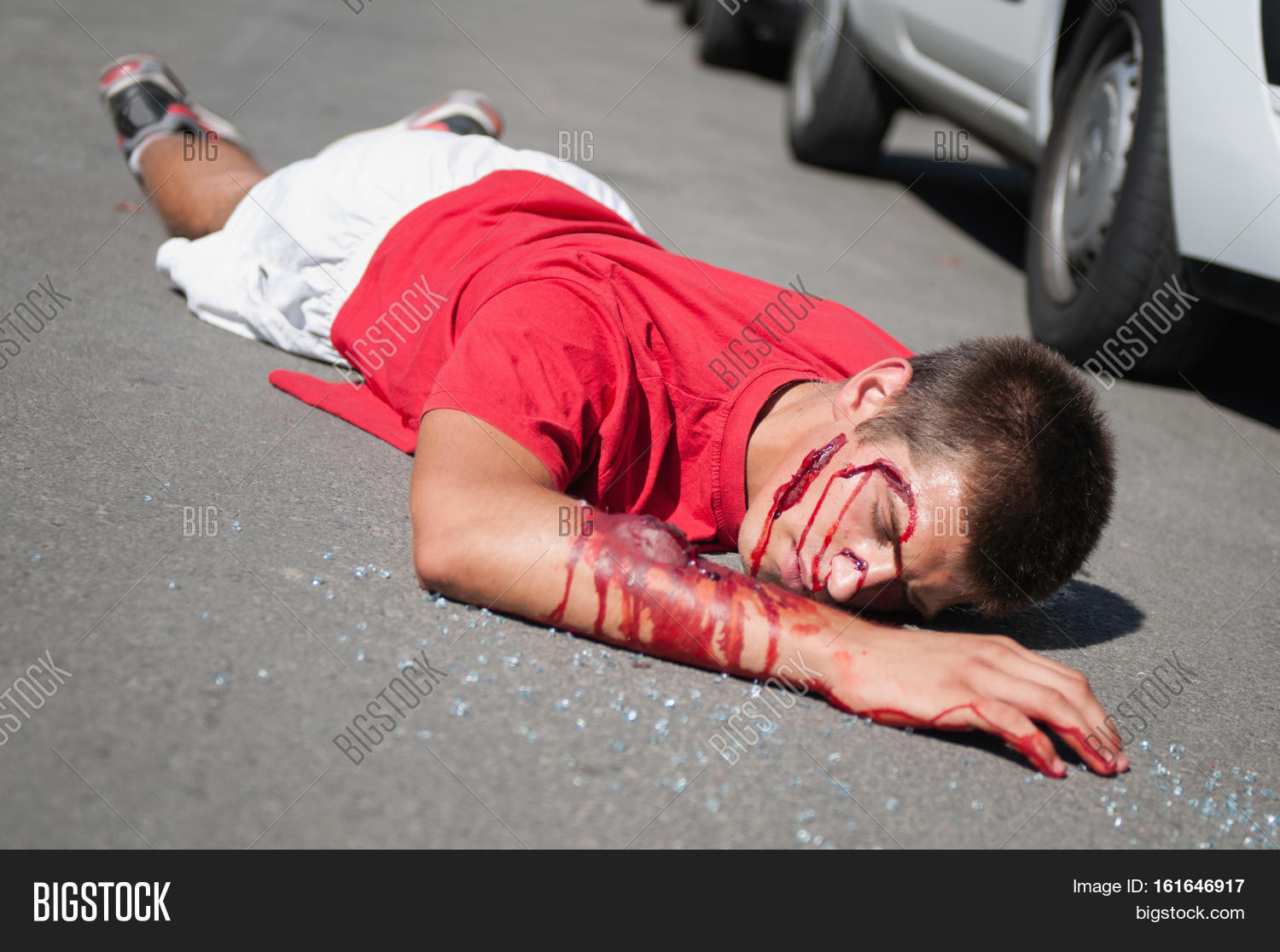 car,accident,victim,pedestrian,killed,dead,body,blood,gore,red,people,Bizarre,Death,Horror,Horizontal,Crash,Street,Road,Adult,Young,man,Lying,glass,broken,arm,fracture,outdoors,sunlight