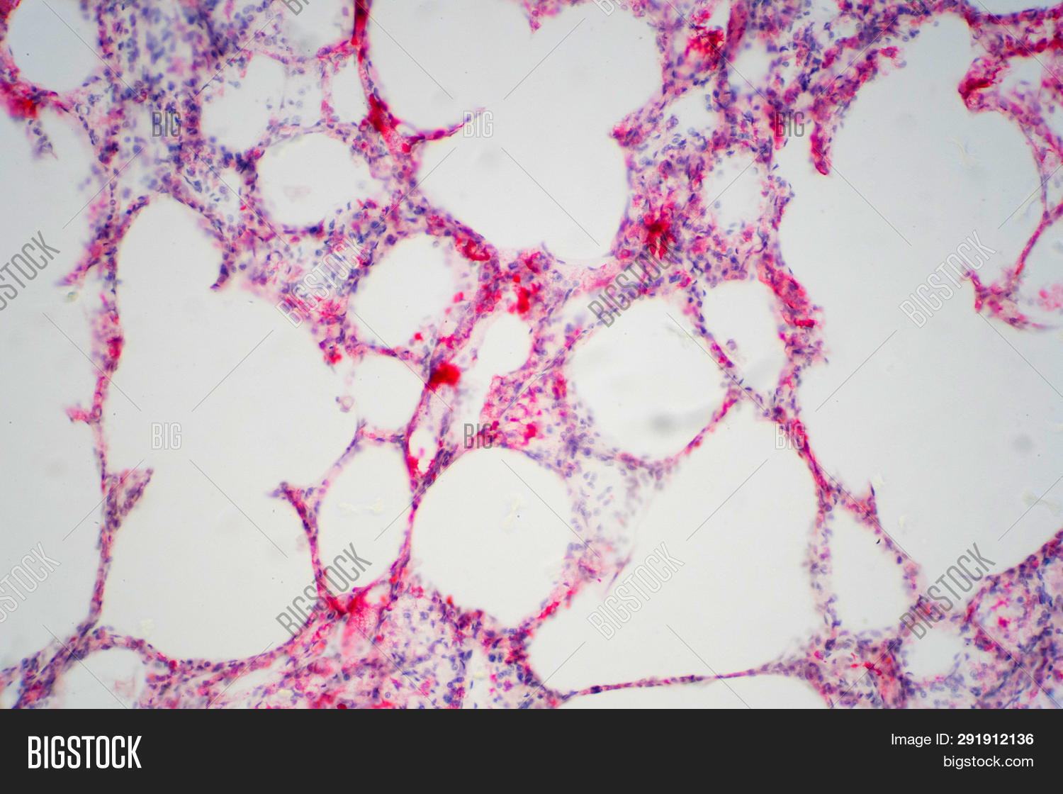 air,anatomy,background,biology,body,breath,breathe,bronchi,cancer,care,cell,chest,diagram,disease,education,effects,exhale,gullet,health,human,imagination,inhale,laboratory,larynx,lung,medical,medicine,microscope,organ,pulmonary,purify,red,respiration,respiratory,science,scientific,system,technology,tissue,trachea,x-ray
