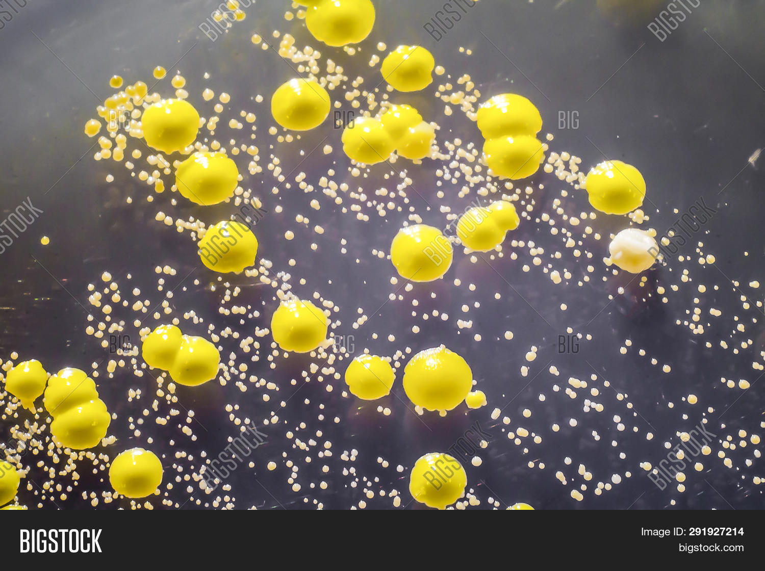 agar,bacteria,bacteriology,cocci,coccus,colony,different,dish,epidermidis,flora,fungi,growth,healthy,luteus,medium,micro,microbe,microbiocenosis,microbiology,micrococcus,microflora,microorganism,microscope,microscopic,microworld,mold,morphology,normal,nutrient,pathogen,pathogenic,petri,plate,shape,skin,smear,soy,spherical,staphylococcus,tryptic,tsa,white,world,yellow
