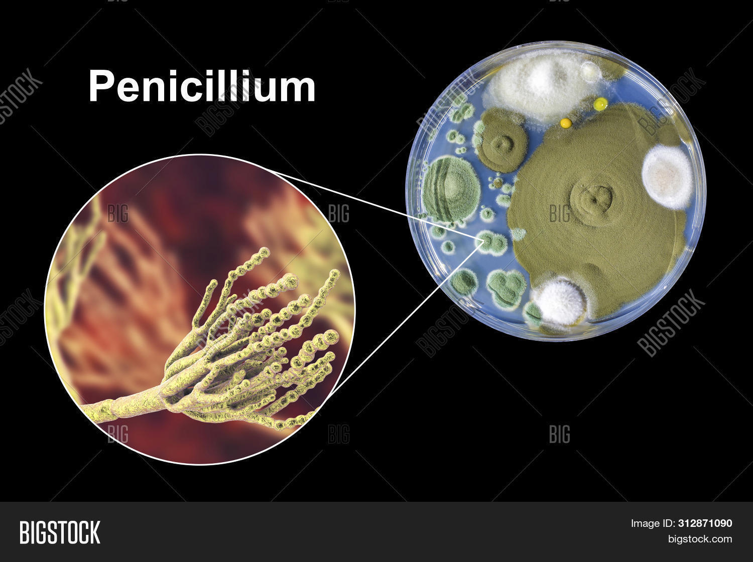 3d,agar,antibiotic,background,black,cheese,colony,conidia,conidiophore,dextrose,dish,eumycota,first,fleming,food,fungal,fungi,fungus,green,growth,health,illustration,macro,medium,microbial,microbiology,mold,morphology,mould,mycology,mycosis,nature,nutrient,penicillin,penicillium,petri,plate,sabouraud,science,scientific,source,spore