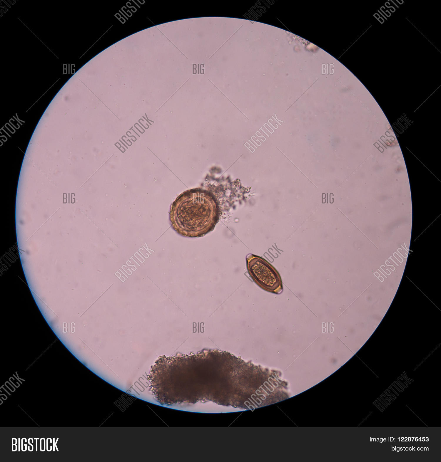 adult,anal,animal,cell,anus,association,biological,biology,blood,conjunction,disease,dna,educational,egg,embryonic,flat,fluke,histology,larva,liver,medical,medicine,micro,microscope,microscopic,microscopy,parasite,parasitic,parasitism,schistosomiasis,schizoids,schizos,science,scientific,tissue,trematode,worm,zoological,zoology