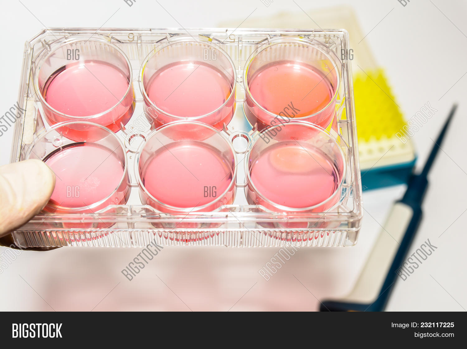 analysis,analyzing,bio,biological,biology,biotechnology,cell,cellular,clinic,culture,diagnosis,discovery,equipment,eukaryote,eukaryotic,experiment,genetic,growth,health,healthcare,human,lab,laboratory,line,liquid,media,medical,medicine,molecular,pipette,plastic,plate,red,research,researcher,sample,science,scientific,scientist,stem,sterile,study,technology,test,well