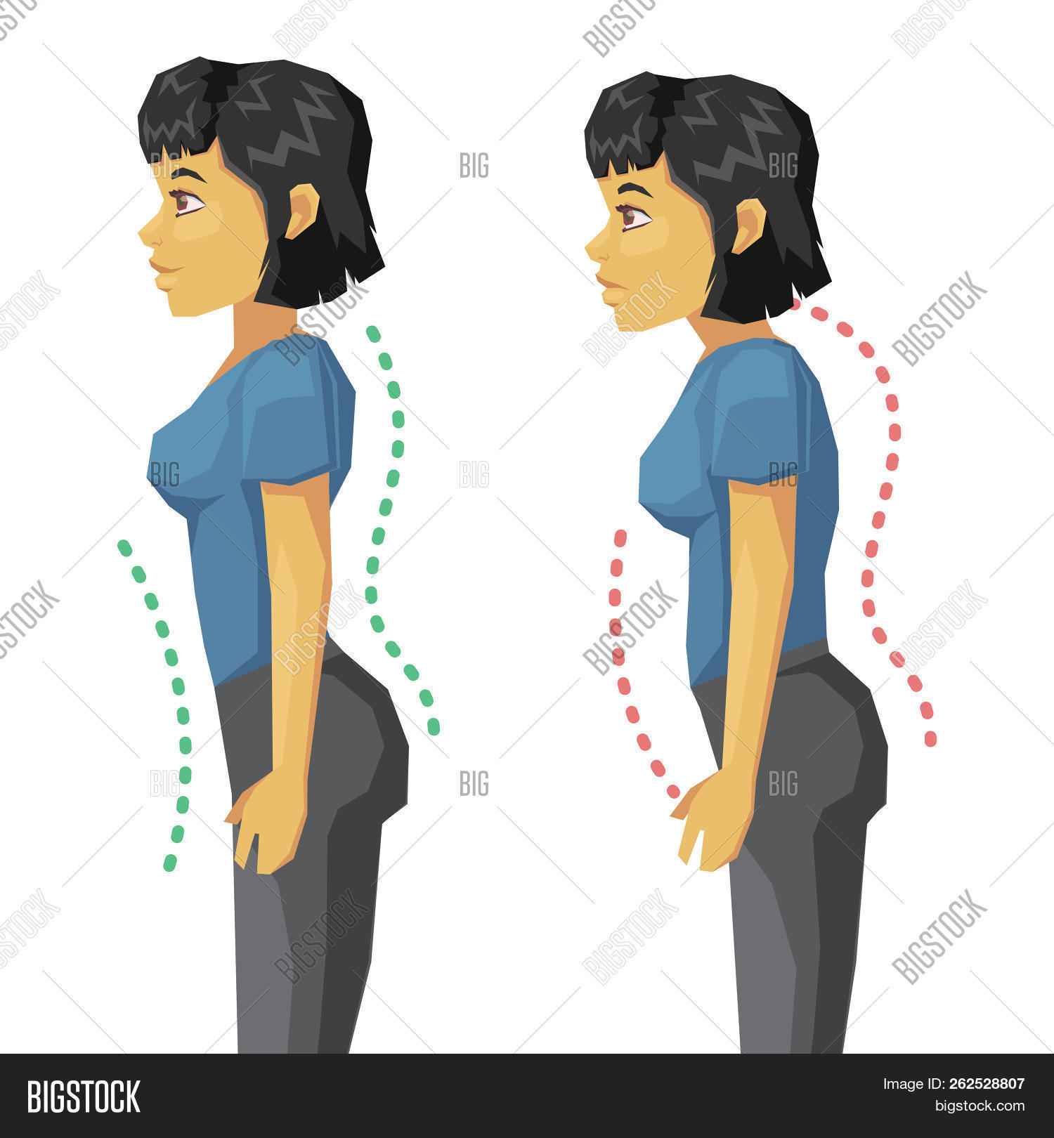 abdominal,alignment,anatomy,back,bad,balance,beauty,belly,bend,body,care,cartoon,chest,correct,curve,developing,diagram,fat,figure,good,guide,head,health,healthy,high,illustration,incorrect,introduction,life,look,make,medical,neck,pain,people,perfect,personal,personality,poor,position,posture,shoulder,side,spine,standing,stretch,style,traits,treatment,woman