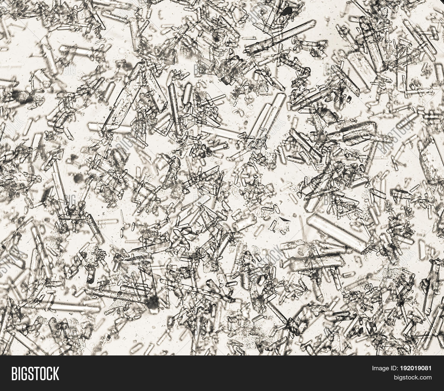 alkaline,amorphous,analysis,area,caclium,carbonate,cell,closeup,coffins,crystal,diagnostic,drop,dumbbell,granules,human,ill,image,laboratory,leukocyte,liquid,macro,medical,microscopy,nature,neutrophil,painful,pathology,phosphates,salt,sick,small,smear,triple,urina,urinalysis,urine,yellow