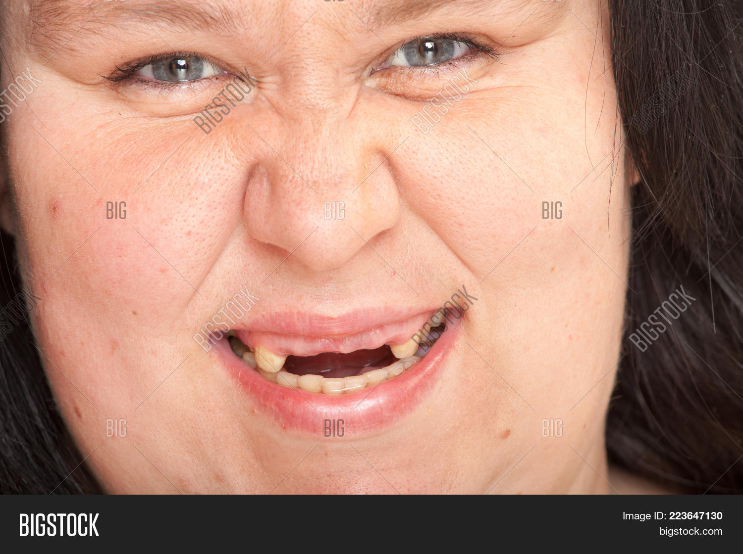 background,beauty,body care,care,close up,closeup,crazy woman,dental,dentist,dentistry,diet,disabled,disorder,face,female,girl,halloween,handicapped,health,health plan,healthcare,home,hygiene,insurance,lips,medical,missing teeth,missing tooth,monster,mouth,oral,oral care,people,poverty,problem,right,smile,teeth,teeth smile,tooth,toothless,trouble,ugly,ugly woman,vampire,violence,witch,woman,wound,wounded
