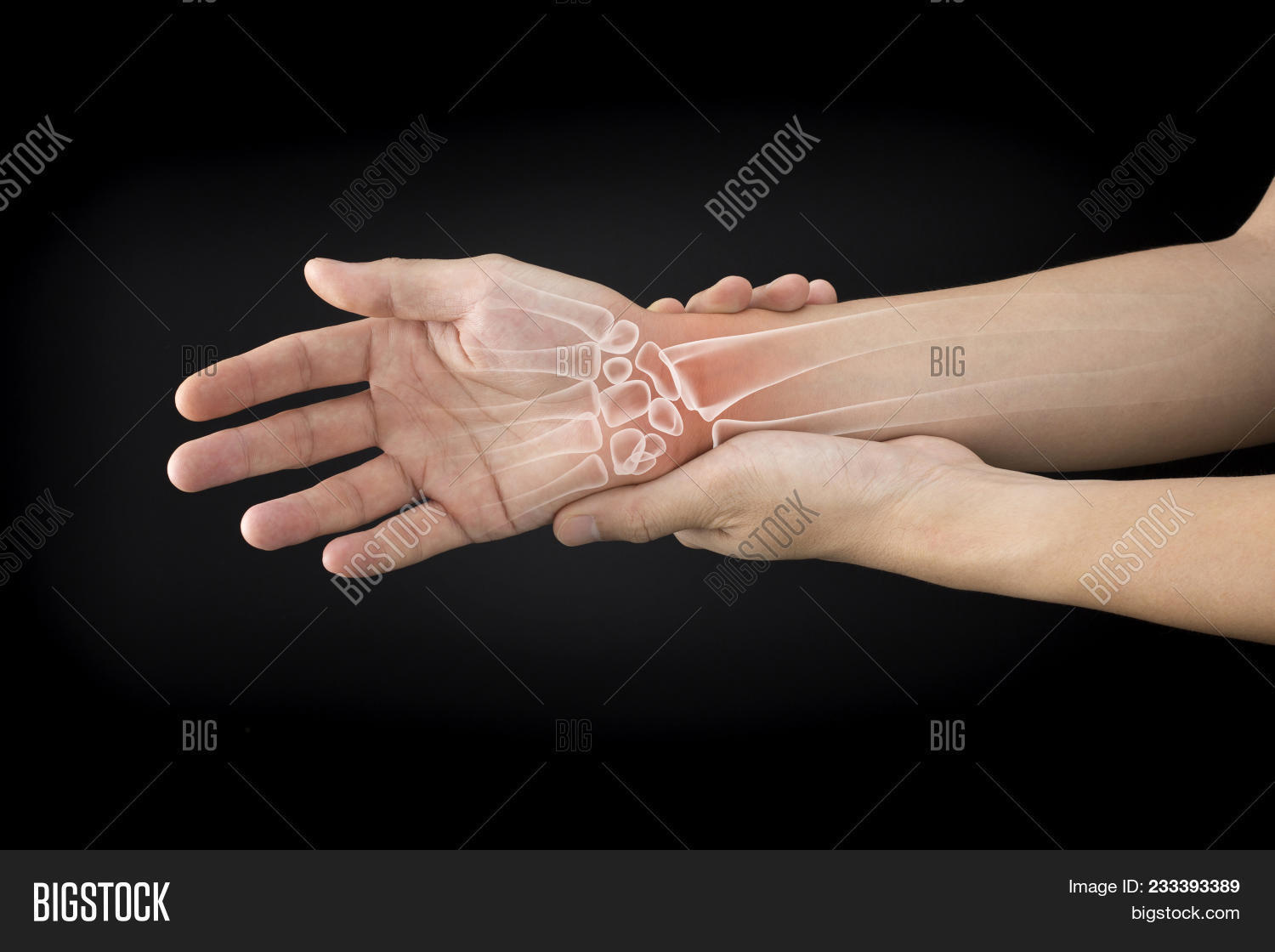 Brittle,Treatment,ache,arthritis,bone,calcium,carpal,chronic,cramp,disease,feeble,forearm,fracture,healthcare,illness,inflame,joints,marrow,medulla,metacarpal,numbness,office,orthopedic,osteoarthritis,osteoporosis,pain,painful,phalanges,physical,pisiform,pressure,rheumatism,rheumatoid,ribs,rickets,sinews,skeleton,sprain,strain,swell,syndrome,tendonitis,therapy,tuberculosis,wrist,x-ray