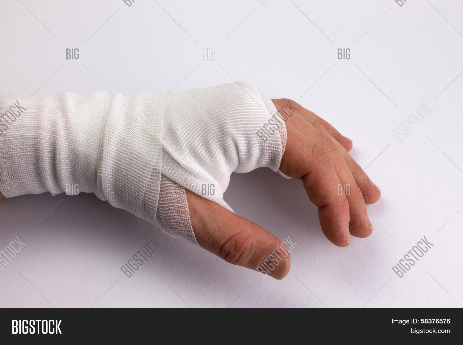 accident,adhesive,aid,arm,bandage,clumsy,connect,cure,doctoring,dressings,dub,emergency,finger,first,gauze,grief,hand,heal,healthy,help,hospital,hurt,inadvertently,injured,injury,intact,leukotape,medical,medicine,mull,op,operation,pain,physician,plasters,post-treatment,prevention,provided,set,sick,suffering,surgery,tape,thumb,treat,treatment,work,work injury