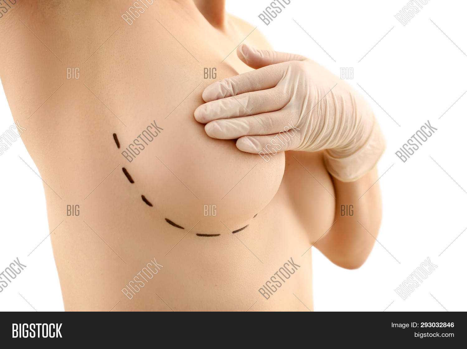 aesthetics,aging,attractive,augmentation,beautiful,beauty,body,boobs,breast,bust,cancer,care,correction,cosmetic,cosmetology,disease,examination,female,fit,glands,hand,health,healthcare,hospital,increase,inflammation,isolated,lift,lifting,mammary,mastitis,medical,medicine,natural,operation,patient,plastic,procedure,reception,rejuvenation,removal,silicone,size,skin,spa,surgery,surgical,treatment,woman