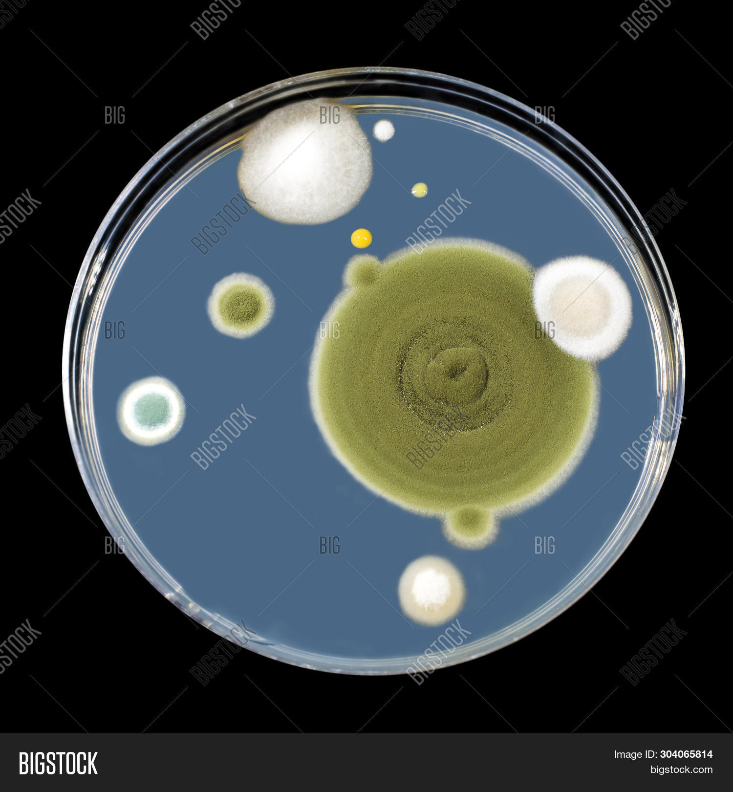 agar,air,allergy,alternaria,aspergillus,asthma,background,black,brown,colony,different,environment,environmental,fischeri,fungi,growth,indoor,isolated,medium,micro,microbe,microbiology,microorganism,microscope,microscopic,microworld,mold,morphology,mycology,nutrient,pathogen,pathogenic,plate,sda,shape,smear,spherical,surface,terreus,white,world