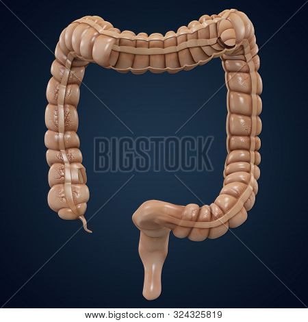Large Intestine Anatomy Cutaway Colon Layout. 3d Rendering image ...