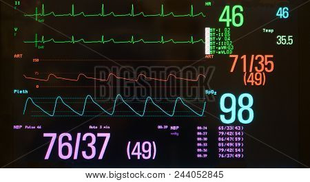 ✅ A Monitor With A Black Screen Showing A Slow Heart Rate On The Ecg, Low  Blood Pressure On The Arteri image & stock photo. 244052845