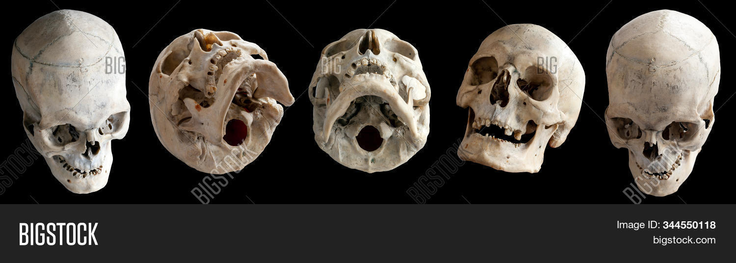 skull,human,isolated,set,full,face,profile,background,different,angle,white,medical,jaw,head,halloween,medicine,anatomy,skeleton,death,physiology,symbol,horror,decay,bone,hell,cranium,view,scary,dead,education,gothic,health,real