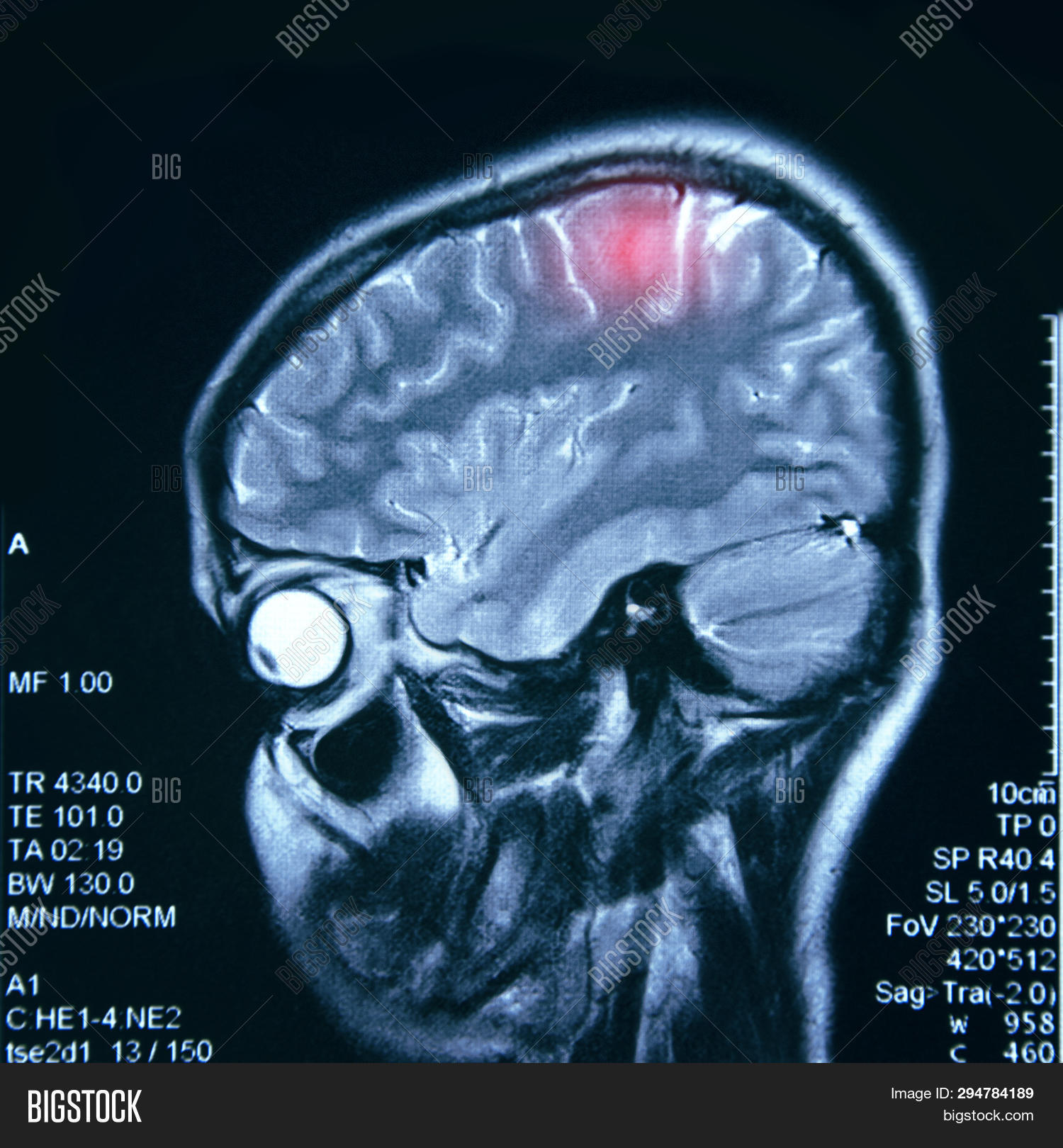 Mri Of The Brain Research Diagnosis And Treatment Of Brain Problems 