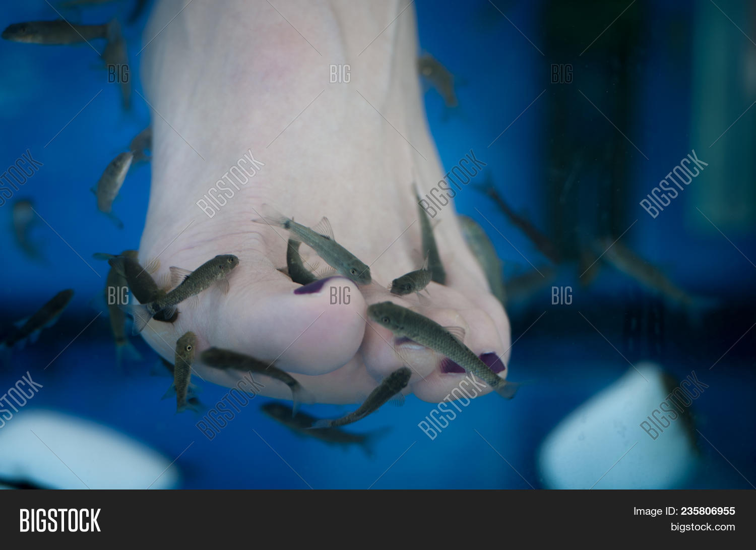 Beauty,Garra,Spa,Treatment,bacteria,barefoot,baths,blue,body,care,colour,dead,doctor,eat,feet,fish,foot,health,horizontal,human,image,kangal,leg,medicine,nail,pedicure,rufa,skin,tank,therapy,toe
