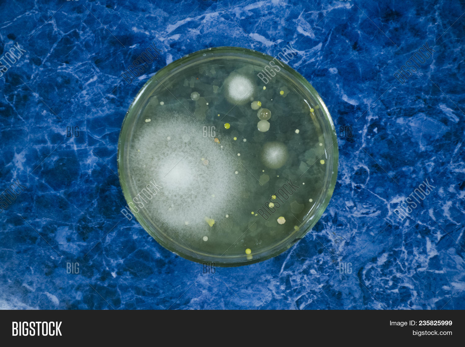 bacilli,bacteria,bacterium,biology,biotechnology,cell,colony,culture,dish,equipment,growing,health,hygiene,isolated,lab,laboratory,micellar,microbiology,microorganism,mold,mushrooms,organism,petri,research,science,scientific,spores,virus,white,wrinkled,yeast