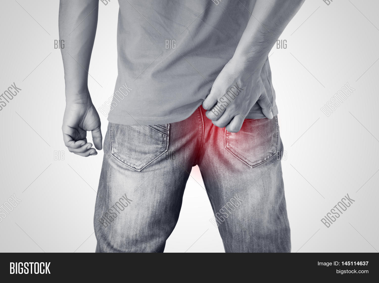 ass,itch,treatment,scratch,buttock,man,mosquito,bite,dermatology,rash,skin,dermatitis,eczema,system,allergy,hand,hold,malaria,remedy,arm,problem,scratchy,bum,anus,itchy,fungus,pain,ache,trichophytor,rubrum,tinea,cruris,dirty,clothing,unclean,insanitary,people,black,white,background,isolate,symptom,disease,cratching,grab,health,excretory,candida,albicans