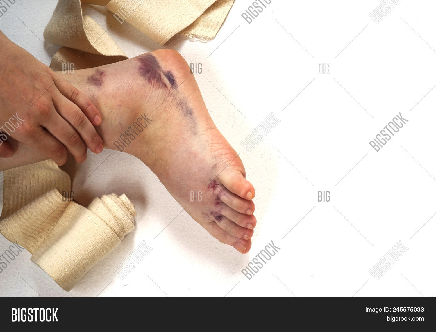 above,accident,aid,ankle,athletic,background,bandage,bandaging,boy,broken,care,composition,concept,creative,doctor,exercise,feet,female,finger,floor,foot,fracture,hand,health,healthcare,healthy,human,hurt,injured,injury,leg,lifestyle,male,man,medical,pain,running,sport,sprain,sprained,toe,trauma,treatment,twisted,view,white,wooden,wound,young