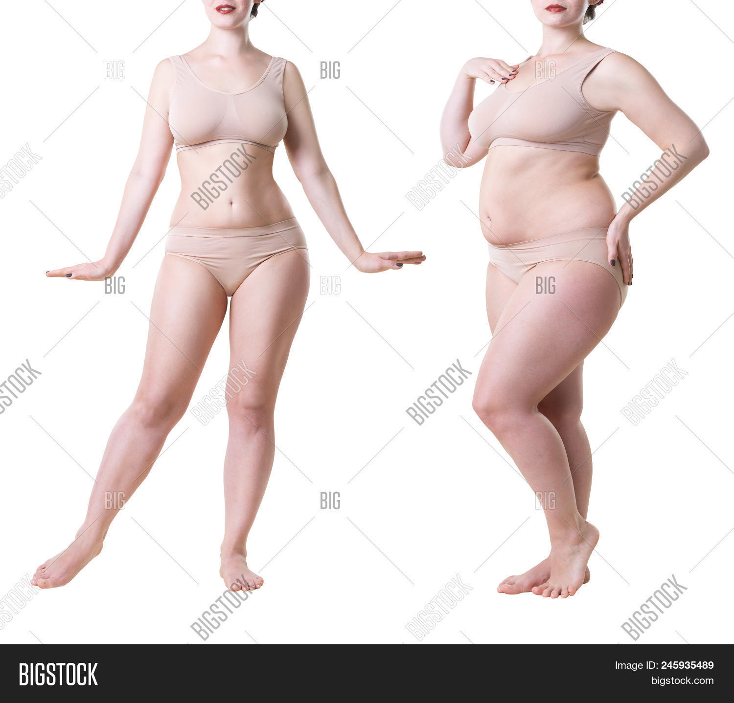 abdomen,abdominal,adiposity,after,beauty,before,belly,big,body,breast,care,cellulite,cellulitis,diet,dieting,excess,fat,fatty,female,girl,healthy,large,legs,liposuction,lose,loss,obese,obesity,overweight,paunch,people,perfect,plastic,rejuvenation,shape,skin,slim,slimming,stomach,surgery,thick,thighs,thin,tummy,underwear,unhealthy,waist,weight,wellness,woman