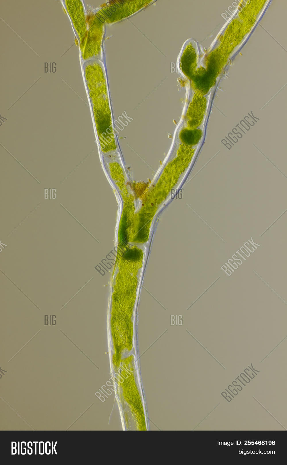Cladophora,Rheinberg,algae,aquatic,biology,botanical,botany,branch,cell,cellular,chlorophyll,close,close-up,detail,ecology,enlarge,enlarged,eucaryote,eukaryote,forked,green,illumination,light,live,macro,magnification,magnify,micrograph,microphotograph,microphotography,microscopic,microscopy,multicellular,nature,organism,plant,science,scientific,transmitted,up