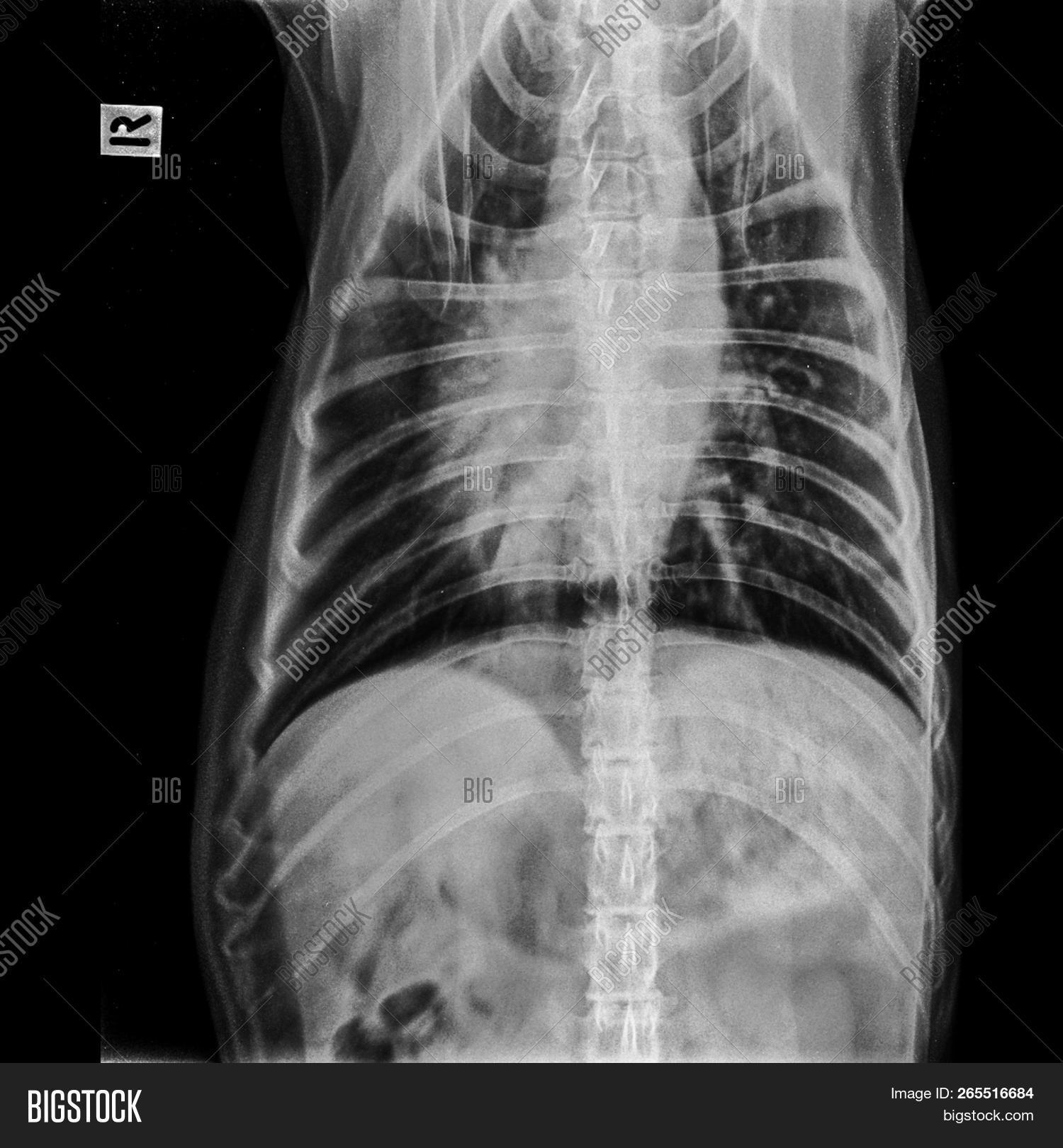 Dog,Kidney,Medicine,Physiology,Science,anatomy,animal,asthma,bone,care,checking,chest,clinic,coughing,disease,elbow,emergency,femur,film,health,hospital,illness,inside,joint,knee,leg,liver,lung,medical,orthopedic,painful,pet,pneumonia,pulmonary,ray,respiratory,ribs,senior,sick,sickness,skeleton,spinal,spine,surgery,thorax,treatment,vet,veterinarian,veterinary,x