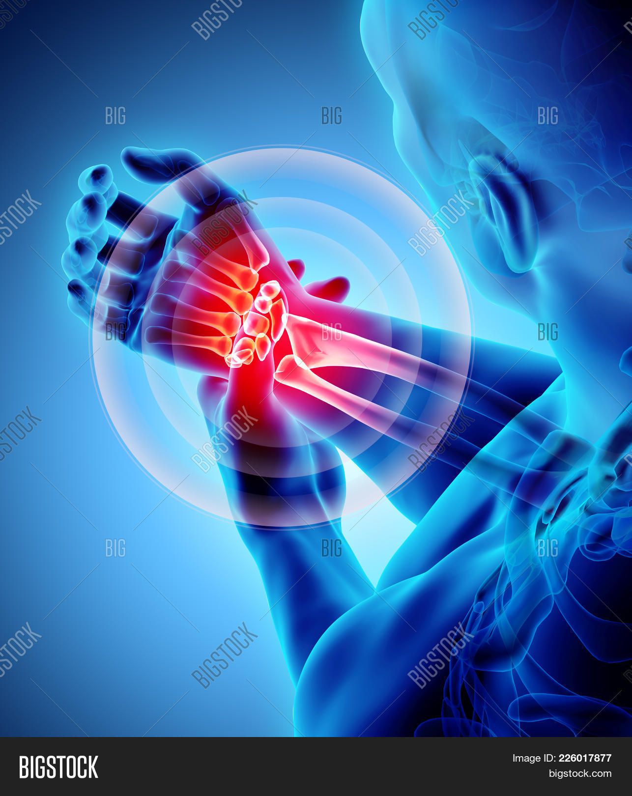 3d,anatomy,arm,arthritis,blue,body,business,care,carpal,color,female,fingers,hand,health,healthcare,human,illustration,image,injury,isolated,joint,medical,medicine,muscular,office,osteoarthritis,pain,painful,part,path,people,physical,rheumatism,science,skeleton,syndrome,technology,tunnel,white,woman,work,wrist,x-ray,young