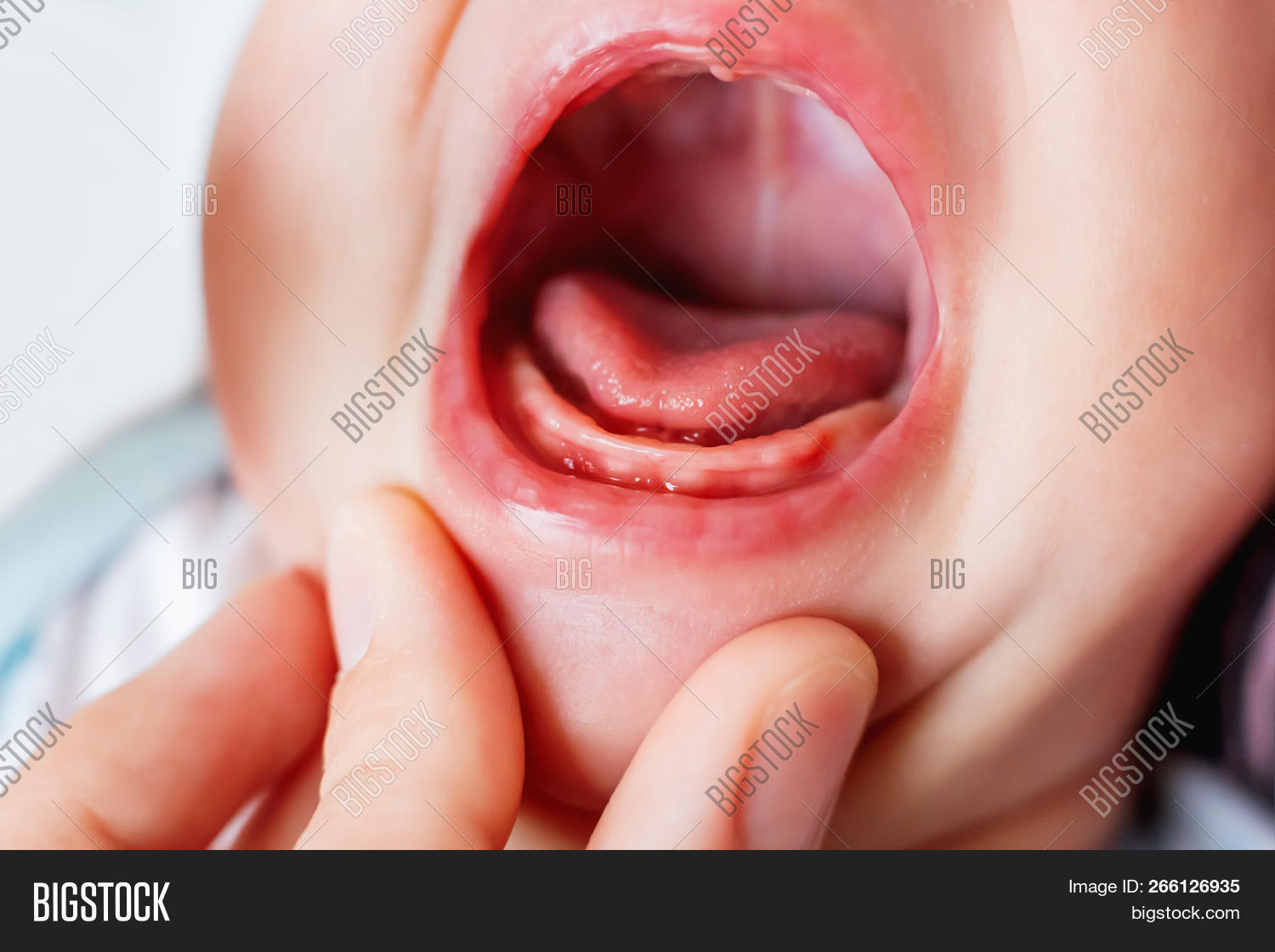 ache,baby,boy,care,child,close,colic,cry,dental,face,girl,gums,health,hysteric,kid,macro,mouth,newborn,pain,painful,soreness,teeth,tongue,up