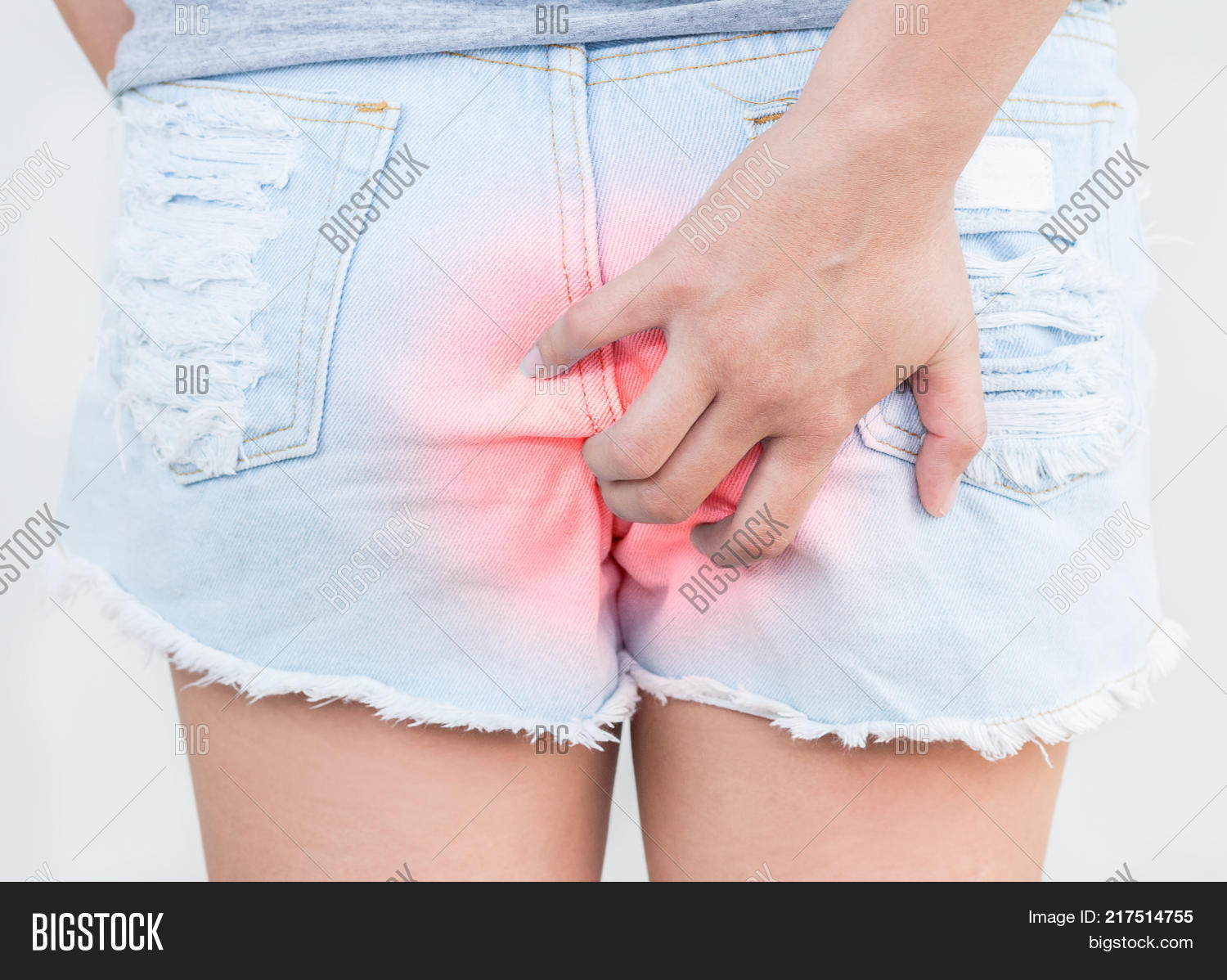 abscess,anal,anus,back,biology,bleeding,blood,bowel,butt,buttocks,colon,diarrhea,digestion,digestive,discomfort,disease,disorder,female,fistula,gut,haemorrhoids,hand,health,healthcare,hemorrhoids,ill,illness,infection,inflamed,inflammation,internal,intestine,itching,medical,medicine,pain,painful,rash,rear,rectum,sexy,sick,skin,stool,suffer,swollen,system,tissue,veins,woman