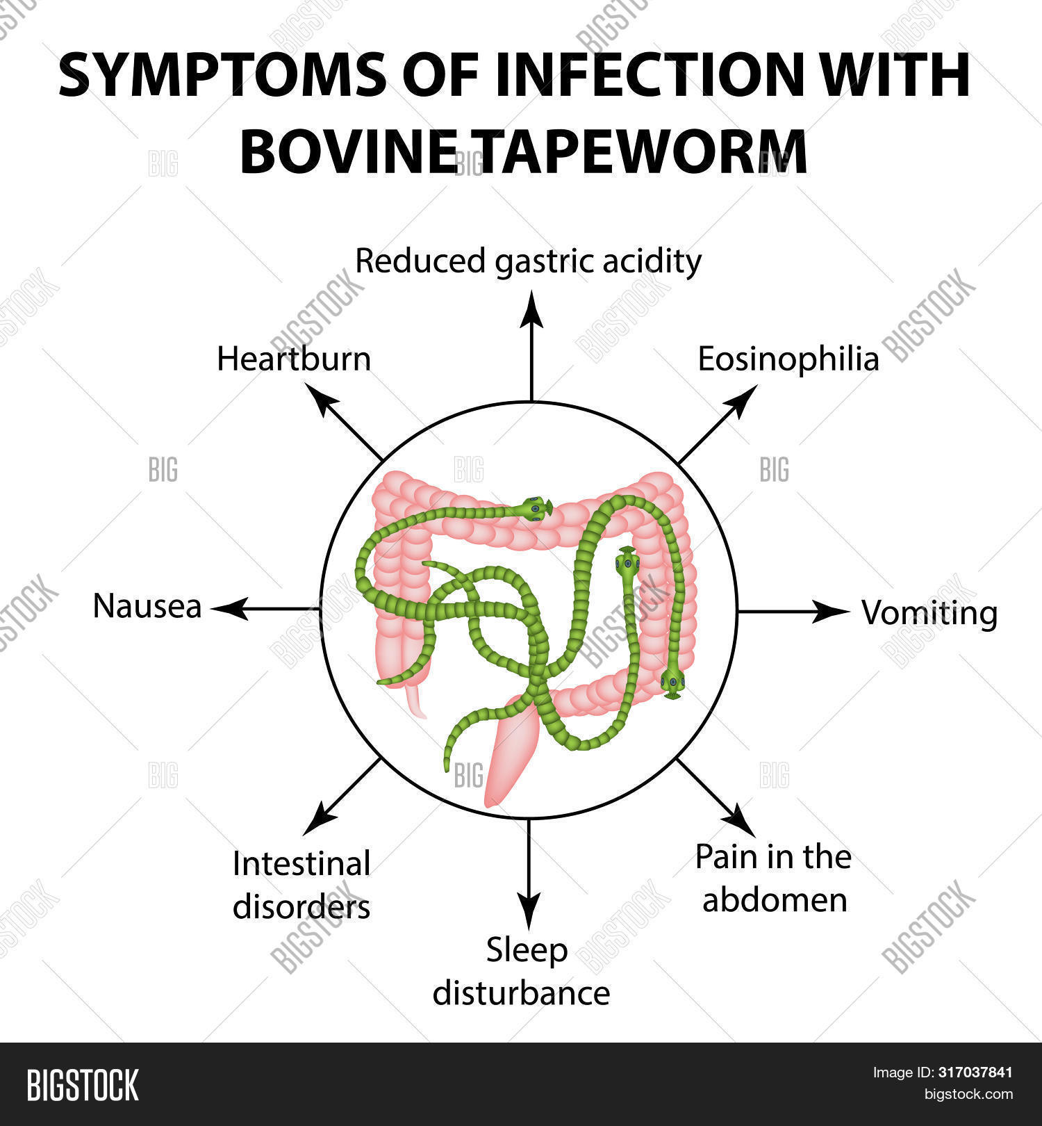 Symptoms Of Infection Are Bovine Tapeworm. Infographics. Illustration ...