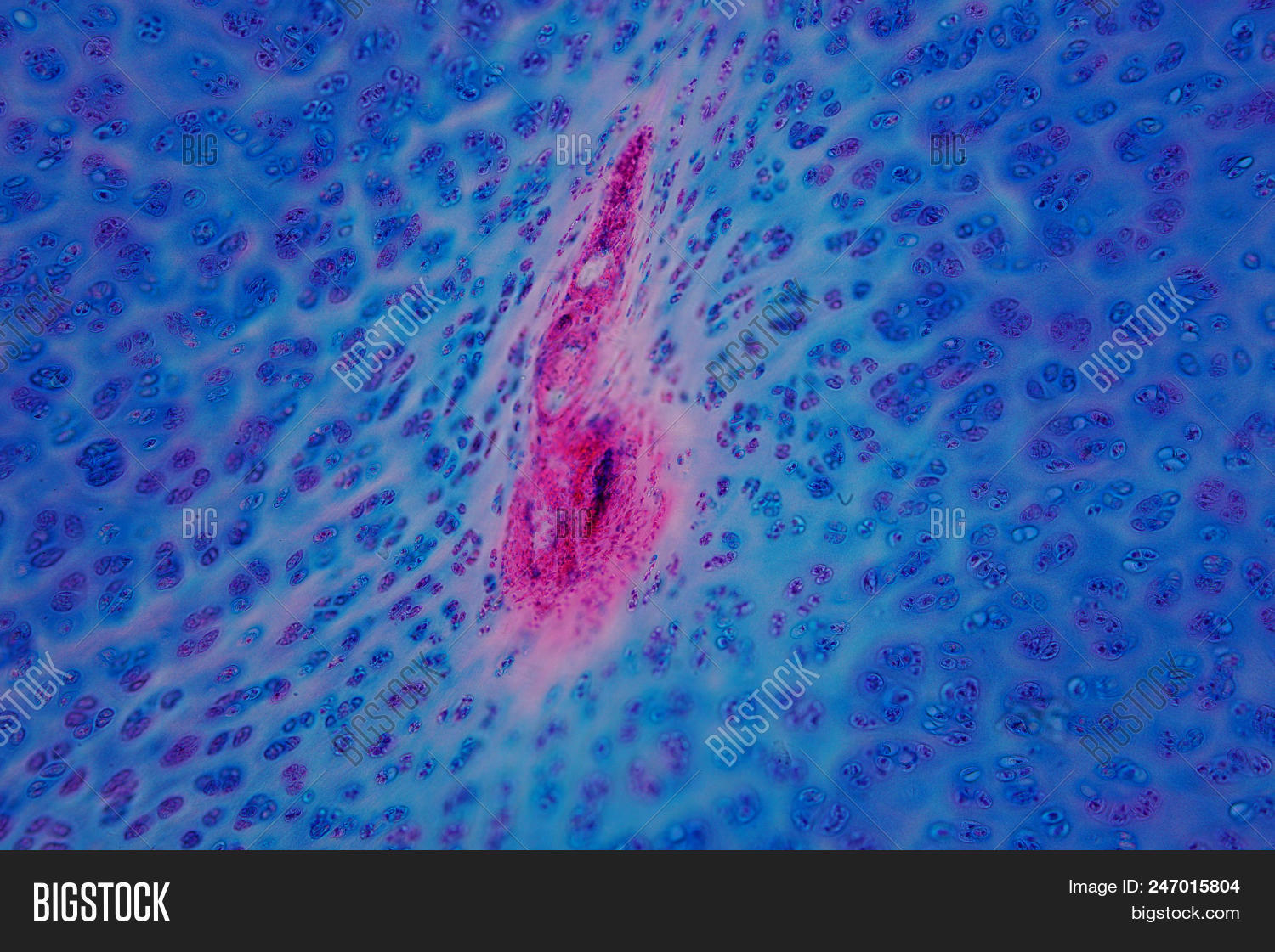 background,biology,body,bone,cartilage,cell,color,connective,cross,ears,histology,human,hyaline,image,larynx,light,magnification,medicine,microbiology,micrograph,microscopic,muscle,nose,ossification,osteocyte,pattern,people,photomicrograph,research,science,scientific,section,septum,skeleton,tissue