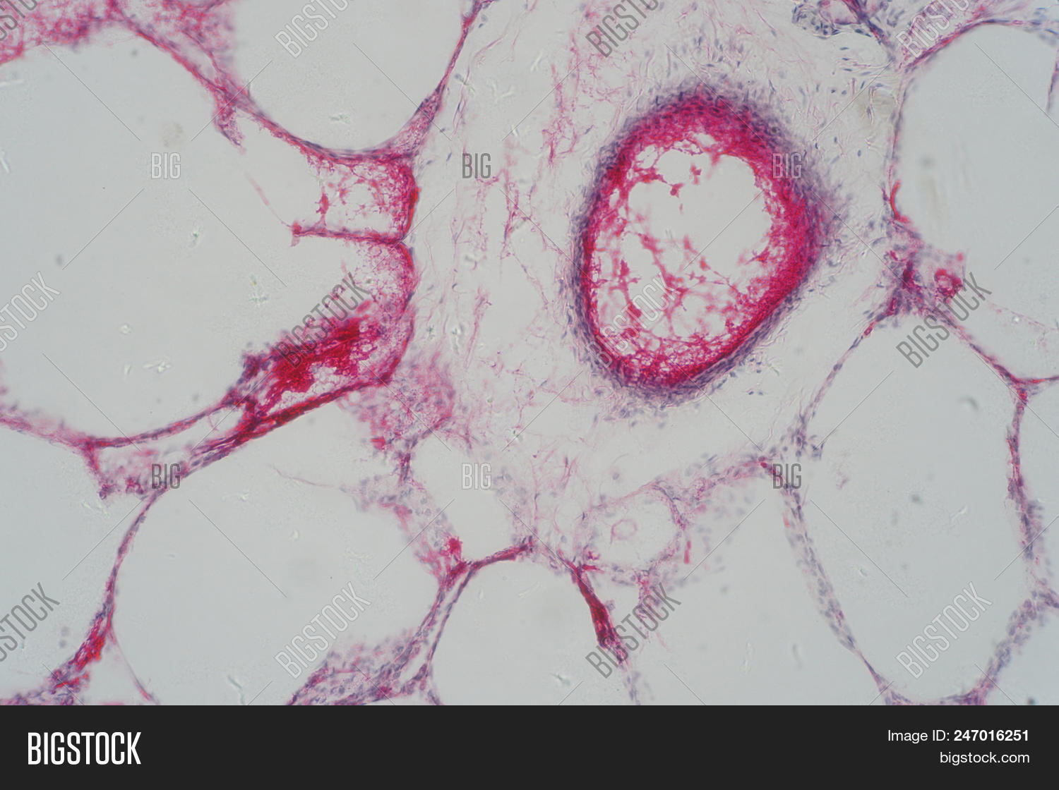 air,anatomy,background,biology,body,breath,breathe,bronchi,cancer,care,cell,chest,diagram,disease,education,effects,exhale,gullet,health,human,imagination,inhale,laboratory,larynx,lung,medical,medicine,microscope,organ,pulmonary,purify,red,respiration,respiratory,science,scientific,system,technology,tissue,trachea,x-ray