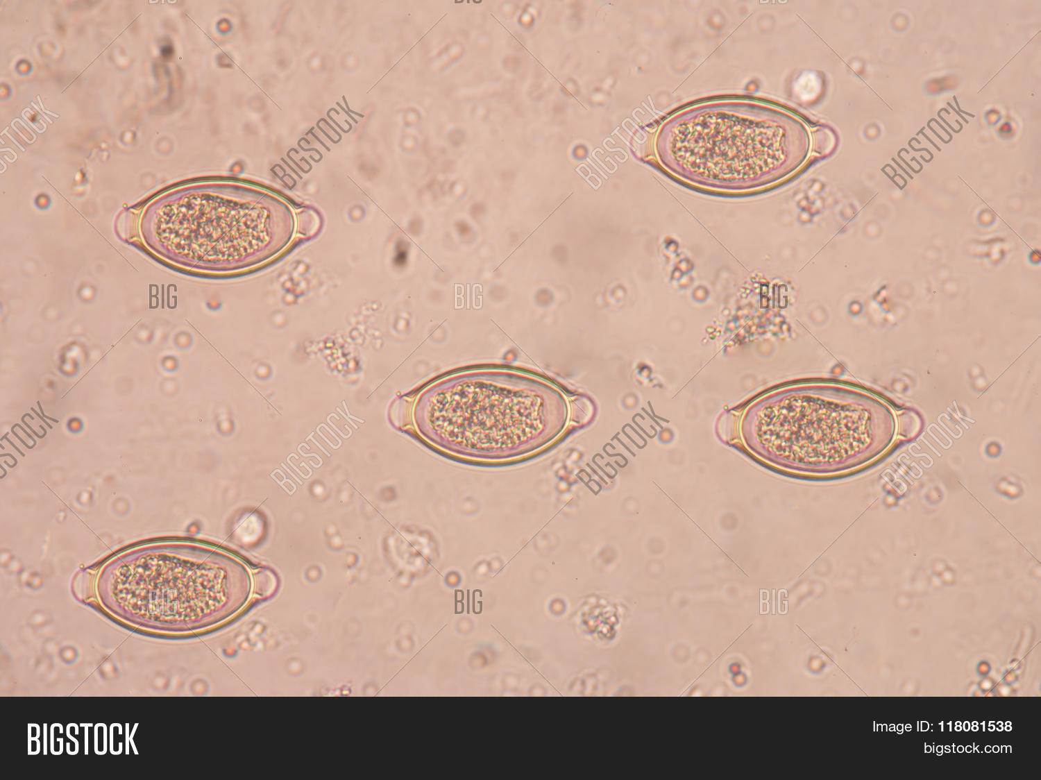 anal,animal,anus,association,biological,biology,blood,conjunction,disease,dna,educational,flat,fluke,histology,liver,medical,medicine,micro,microscope,microscopic,microscopy,parasite,parasiteras,parasitic,parasitism,schistosoma,schistosome,schistosomiasis,science,scientific,tissue,trematoda,trematode,trichiura,trichiuris,trichocephalus,trichuris,worm,zoological,zoology
