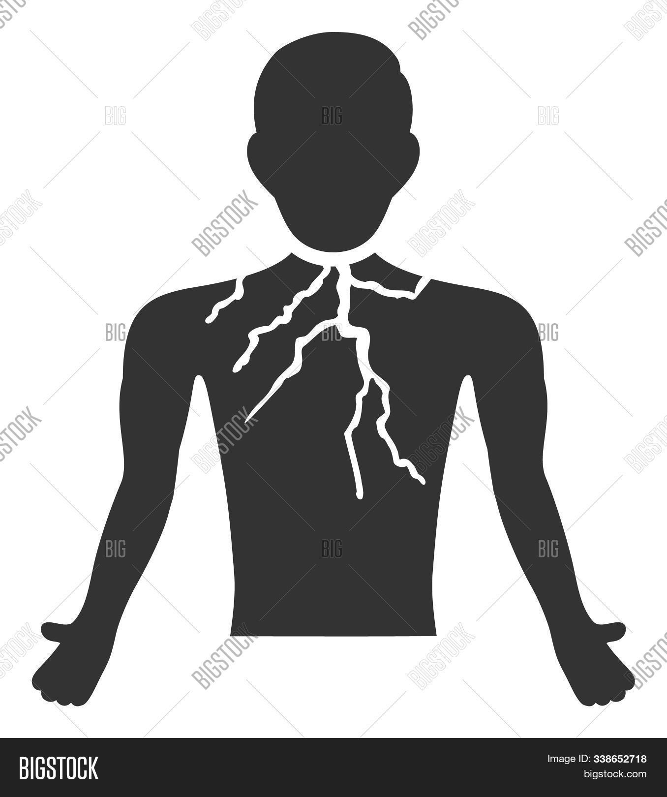adenocarcinoma,asthma,cancer,cancerous,carcinoma,chest,diagnose,diagnosis,disease,emphysema,flat,glyph,healthcare,icon,ill,illness,isolated,malignancy,malignant,medical,metastasis,metastatic,oncological,oncology,pathology,patient,pictogram,pictograph,pneumonia,problem,pulmonary,raster,respiratory,sick,sickness,symbol,thorax,trachea,tuberculosis,tumor