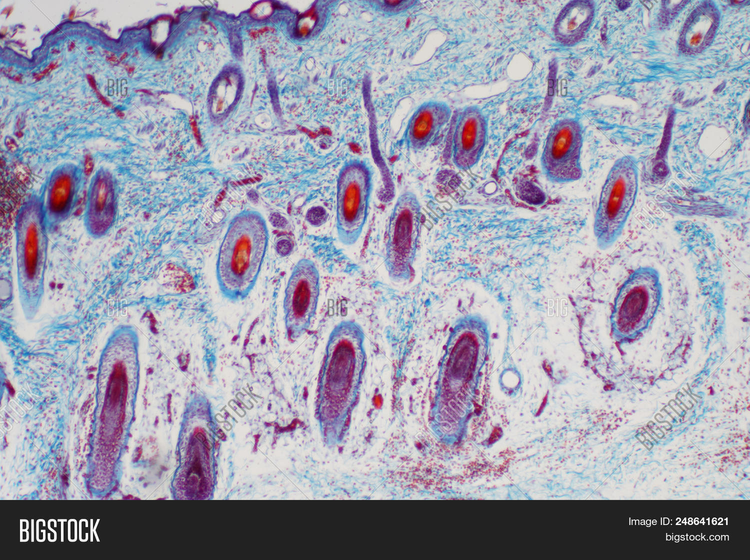 anatomical,anatomy,background,biology,blood,body,cell,collagen,corneum,cross,dermatology,dermis,drawing,education,epidermis,fat,follicle,gland,granulosum,hair,health,healthcare,human,keratinocyte,layer,medical,medicine,microscope,muscle,nerve,organ,pigment,research,science,scientific,sebaceous,section,sensory,skin,skincare,spinosum,stratum,structure,subcutaneous,sweat,tissue,vein