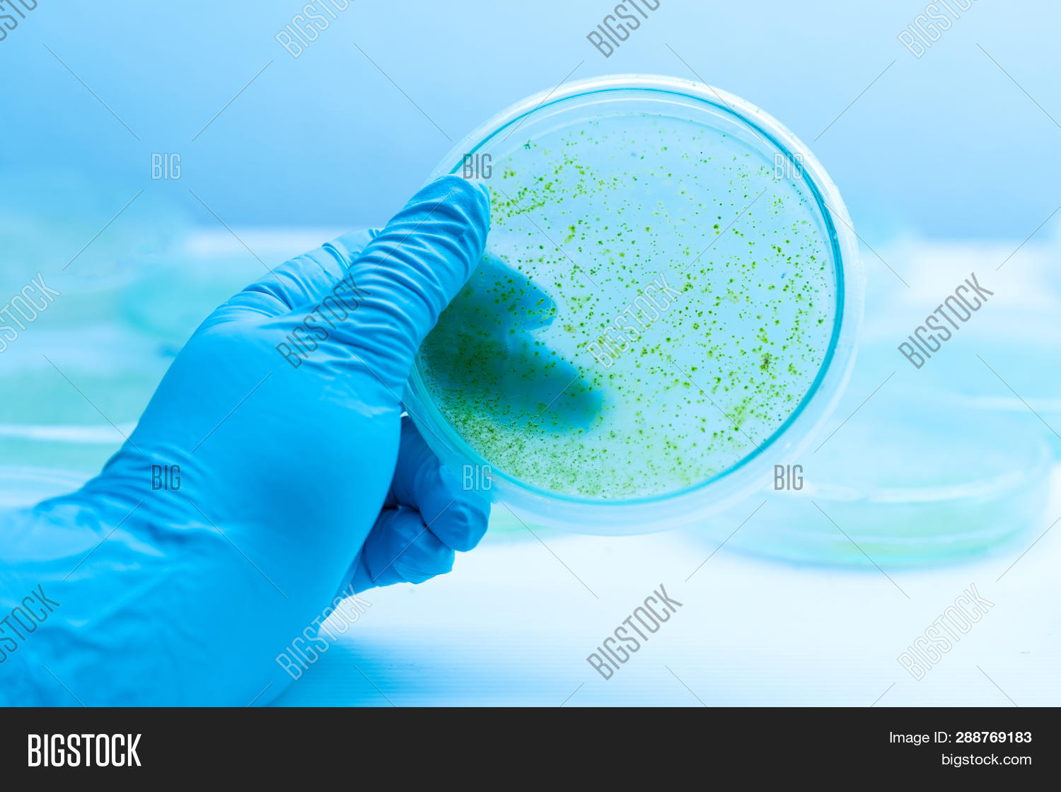 abstract,alga,algae,animal,aquatic,background,bacteria,blue,brown,colonial,colony,color,cyanobacteria,cyanobacterium,detail,ecology,education,environment,filamentous,food,freshwater,grass,green,heterocysts,image,island,laboratory,lake,light,macro,marine,microbiology,microscope,microscopic,nature,nitrogen,ocean,pattern,plankton,plants,pond,science,sea,seaweed,slide,structure,texture,tropical,water