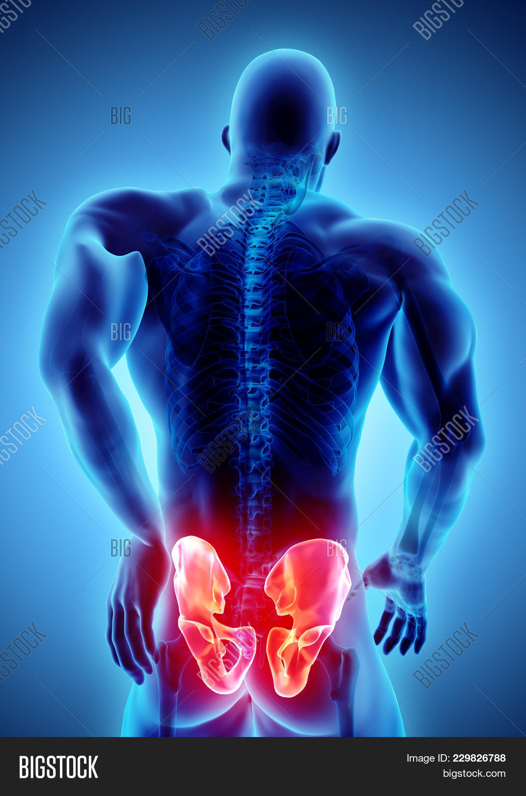 3d,accident,ache,anatomical,anatomy,arthritis,back,biology,blue,body,bone,disease,femur,graphic,health,healthcare,hip,human,hurt,ilium,illustration,inflammation,injury,joint,leg,male,man,medical,medicine,osteoporosis,pain,painful,path,patient,pelvis,physical,red,replacement,rheumatism,sacrum,science,skeleton,spine,surgery,x-ray,young