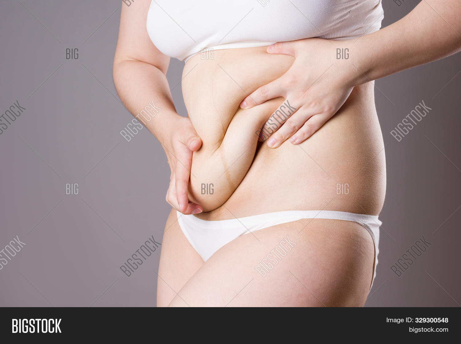 abdomen,abdominal,adipose,adiposity,after,background,belly,big,body,care,cellulite,cellulitis,diet,dieting,excess,fat,female,figure,flab,flabby,fold,gray,growth,hip,human,large,liposuction,lose,loss,obese,obesity,overweight,paunch,people,plastic,pregnancy,pregnant,shape,skin,slimming,stomach,surgery,thick,thigh,tuck,tummy,underwear,waist,weight,woman